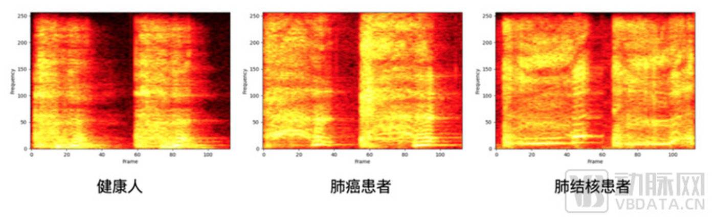 谷歌大模型下场，FDA完成首批，这个AI赛道起飞在即