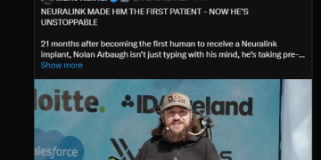 「机械飞升」将成真？Neuralink首例受试者近况曝光 马斯克暗示其将植入双脑机设备