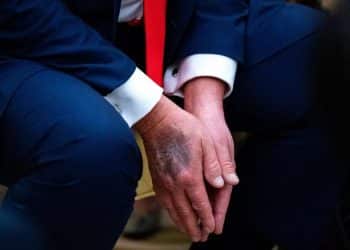 「每天从上午10点工作到晚上7、8点」，79岁特朗普，手背出现大面积淤青！他承认长期大量服用阿司匹林，剂量远高于医生建议