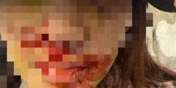 金晨驾车发生事故后自行离去就医，警方最新通报后，她和助理还需要担责吗？律师解读